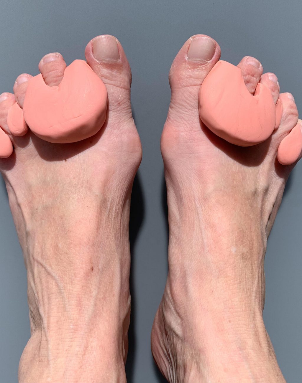Nachtprothese voet